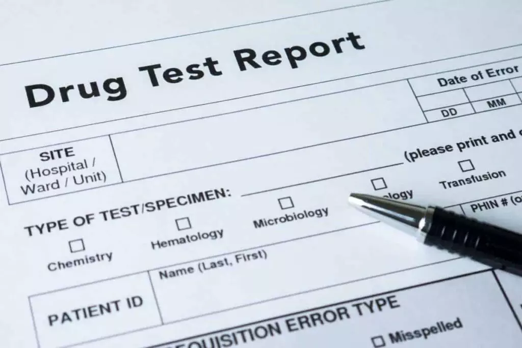 DOT pre-employment drug test