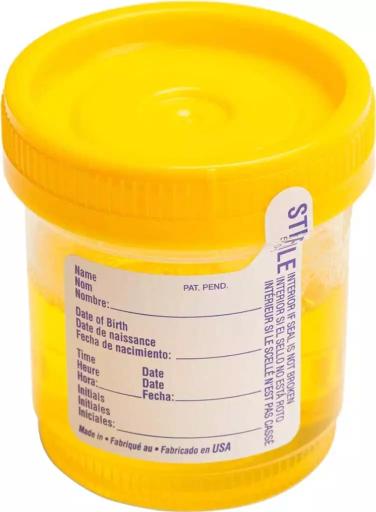 drug urine test yellow cup